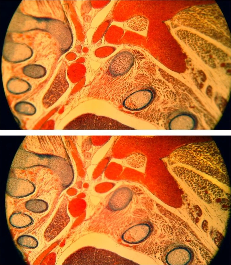 Fig. 12. Demonstration of the selective autofocus, histological routine slice (rat embryo), bright-field, unfiltered incandescent light, student microscope Leitz HM-Lux, Phaco 10/0.25 (basic achromatic objective, Will Wetzlar), eyepiece: Periplan GF 10x/18 (for eyeglasses wearers), extreme edge blurring, automatic focusing for the image center (above) and the image periphery (below).