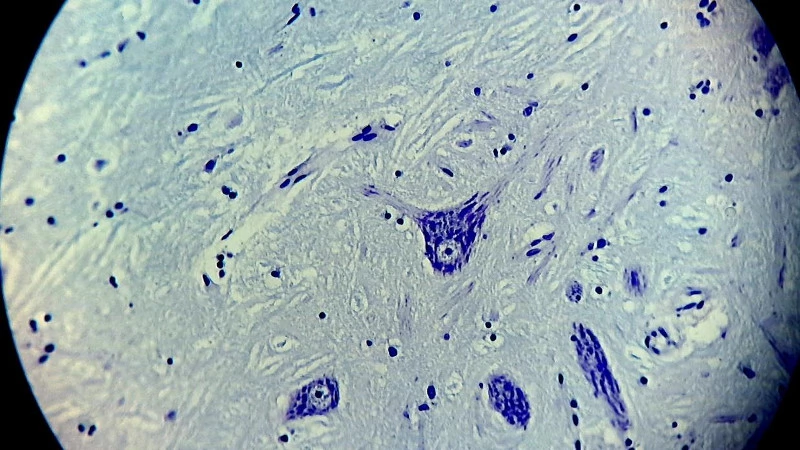 Abb. 7: Verwendung der Kamera mit zugehörigem Kamera-Okular (Fa. Meiji) an einem Leica-Mikroskop DMLB, plan liegender Dünnschnitt von Nervengewebe (Medulla oblongata, Nucleus ambiguus), Nissl-Färbung, Objektiv Plan 40x, Hellfeld, Mikrofoto ohne Zoom, deutliche Randunschärfe des Kamera-Okulars.