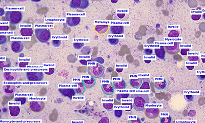 The Imaging Source's Microscopy Cameras Deliver Images for Digital Pathology