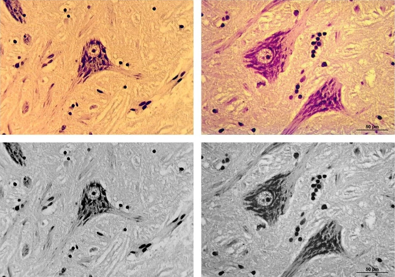 Fig. 17. Nerve cell specimen from Figs 7-9 and 11, Microscope: Leica DMLB, Objective: Plan 40x, bright-field, tested camera used with Meiji eyepiece (left), Leica camera MC 170 HD (right), color images (above), black-and-white conversions (below).