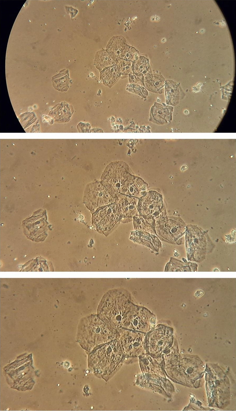 Fig. 10. Image from camera used with Leica teaching-level microscope Leitz HM Lux 3, objective: Phaco L 32/0 40, eyepiece: Periplan GF 10x/18 (for eyeglasses wearers). Wet-mount slide of epithelial cells, phase contrast, image created with simple annular phase rings (without Köhler illumination) micrograph without zoom (top), zoom factor 3x (middle), zoom factor 4x (bottom).