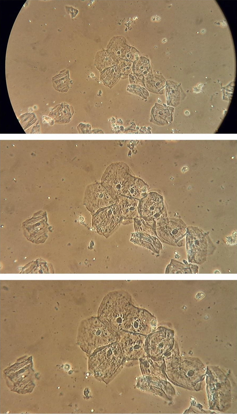 图 10：装置在Leica 教学显微镜─Leitz HM Lux 3 的相机所拍摄出的影像，物镜：Phaco L 32/0 40， 目镜： Periplan GF 10x/18（可供配戴眼镜者使用）。湿型上皮细胞的幻灯片，相位对比，简单的环形环创建影像（没有Köhler照明）。照片不缩放（上图），缩放3倍（中图），缩放4倍（下图）。