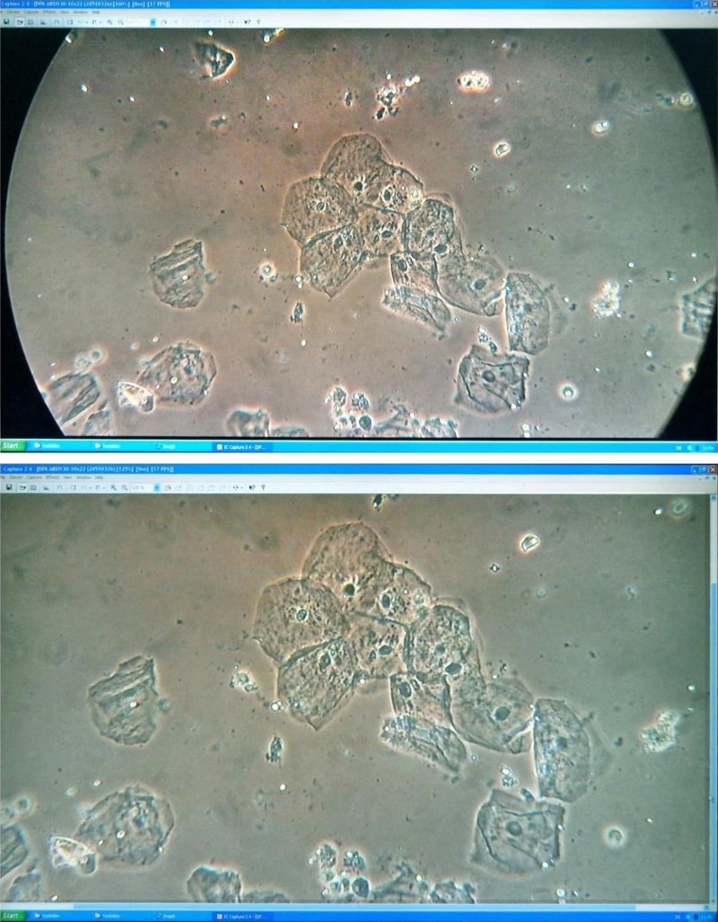 Fig. 6. Monitor image via the Capture software with collapsed 'toolbars' no zoom (top). Moderate zoom (bottom). Free-hand photo of the laptop display. Oral mucosal epithelial cells. Phase contrast. Teaching-level microscope Leitz HM Lux 3 (cf. Fig. 10).