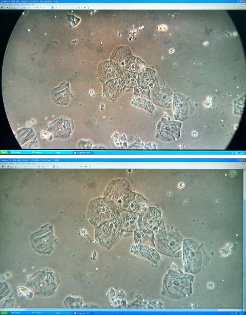 图 6：藉由IC Capture 软件（工具栏隐藏和未变焦）将影像呈现在屏幕上（上图）。适当变焦（下图）。随手获得的照片显示在笔记本电脑屏幕上。口腔粘膜上的表皮细胞。位相差。教学研究用显微镜 - Leitz HM Lux 3 （参照图10）